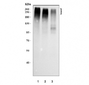 Western blot testing of human 1) plasma, 2) HCCT and 3) HCCP cell lysate with Fibronectin antibody. Predicted molecular weight ~220 kDa (monomer) but may be observed at a higher molecular weight due to glycosylation.