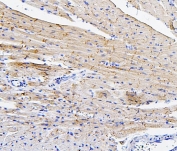 IHC staining of FFPE mouse heart with Connexin 43 antibody. HIER: boil tissue sections in pH6, 10mM citrate buffer, for 20 min and allow to cool before testing.