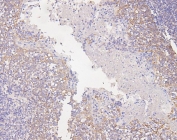 IHC staining of FFPE human tonsil with Connexin 43 antibody. HIER: boil tissue sections in pH6, 10mM citrate buffer, for 20 min and allow to cool before testing.