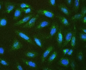 Immunofluorescent staining of FFPE human U-2 OS cells with Connexin 43 antibody (green) and DAPI (blue). HIER: boil tissue sections in pH6, 10mM citrate buffer, for 20 min and allow to cool before testing.