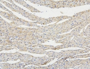 IHC staining of FFPE rat heart with Connexin 43 antibody. HIER: boil tissue sections in pH6, 10mM citrate buffer, for 20 min and allow to cool before testing.