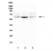 Western blot testing of human 1) A549, 2) PC-3 and 3) U-2 OS cell lysate with SMOX antibody. Predicted molecular weight ~62 kDa.