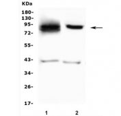 Western blot testing of human 1) A549 and 2) HepG2 lysate with SMURF2 antibody. Predicted molecular weight ~86 kDa.