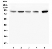 Western blot testing of 1) rat testis, 2) rat pancreas, 3) rat stomach, 4) mouse testis and 5) mouse pancreas lysate with SMURF2 antibody. Predicted molecular weight ~86 kDa.