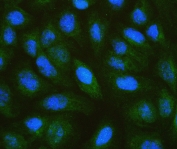 Immunofluorescent staining of FFPE human U-2 OS cells with MTTP antibody antibody (green) and DAPI (blue). HIER: boil tissue sections in pH6, 10mM citrate buffer, for 20 min and allow to cool before testing.