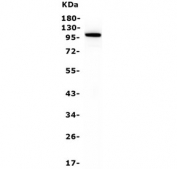 Western blot testing of human HepG2 cell lysate with Nucleolin antibody. Predicted molecular weight ~77 kDa, commonly observed at 100~110 kDa.
