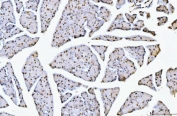 IHC staining of FFPE mouse pancreas with Nucleolin antibody. HIER: boil tissue sections in pH8 EDTA for 20 min and allow to cool before testing.