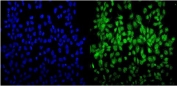 Immunofluorescent staining of FFPE human U-2 OS cells with Nucleolin antibody (green) and DAPI nuclear stain (blue).