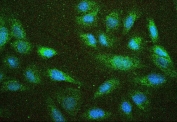 Immunofluorescent staining of FFPE human U-2 OS cells with Merlin antibody (green) and DAPI (blue). HIER: boil tissue sections in pH6, 10mM citrate buffer, for 20 min and allow to cool before testing.