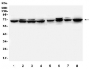 Western blot testing of 1) rat brain, 2) rat thymus, 3) rat liver, 4) rat kidney, 5) mouse brain, 6) mouse thymus, 7) mouse liver and 8) mouse NIH3T3 lysate with Merlin antibody. Predicted molecular weight ~69 kDa.