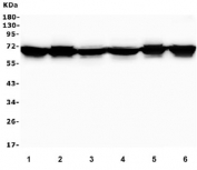 Western blot testing of human 1) Caco-2, 2) HeLa, 3) HepG2, 4) ThP-1, 5) U-2 OS and 6) PC-3 cell lysate with Merlin antibody. Predicted molecular weight ~69 kDa.