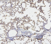 IHC staining of FFPE mouse lung with Merlin antibody. HIER: boil tissue sections in pH6, 10mM citrate buffer, for 20 min and allow to cool before testing.