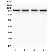 Western blot testing of human 1) MDA-MB-453, 2) Caco-2, 3) PC-3 and 4) HeLa lysate with TRPV3 antibody. Predicted molecular weight ~90 kDa.
