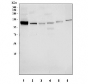 Western blot testing of 1) human U-87 MG, 2) human MCF7, 3) human 293T, 4) human SH-SY5Y, 5) rat heart and 6) mouse heart tissue lysate with NOTCH2 antibody. Predicted molecular weight ~110 kDa.