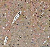 IHC staining of FFPE rat brain tissue with NOTCH2 antibody. HIER: boil tissue sections in pH8 EDTA for 20 min and allow to cool before testing.