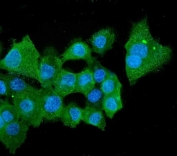 Immunofluorescent staining of FFPE human A431 cells with ALDH2 antibody (green) and DAPI nuclear stain (blue).