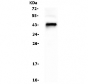 Western blot testing of human Raji cell lysate with CD79a antibody. Expected molecular weight: 25-47 kDa depending on glycosylation level.
