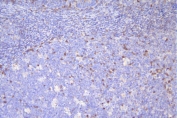 IHC staining of FFPE human tonsil with CD79a antibody. HIER: boil tissue sections in pH6, 10mM citrate buffer, for 20 min and allow to cool before testing.