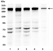 Western blot testing of human 1) Caco-2, 2) U-2 OS, 3) K562, 4) PC-3 and 5) T-47D lysate with TJP1 antibody. Predicted molecular weight ~187 kDa.
