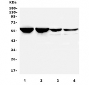 Western blot testing of human 1) rat testis, 2) mouse testis, 3) mouse thymus and 4) mouse HEPA1-6 lysate with PTBP2 antibody. Predicted molecular weight ~57 kDa.
