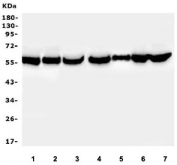 Western blot testing of human 1) MDA-MB-453, 2) U-2 OS, 3) ThP-1, 4) K562, 5) U937, 6) HEK293 and 7) HeLa cell lysate with PTBP2 antibody. Predicted molecular weight ~57 kDa.