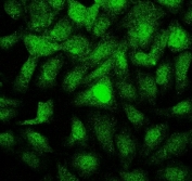 Immunofluorescent staining of FFPE human U-2 OS cells with PTBP2 antibody. HIER: boil tissue sections in pH6, 10mM citrate buffer, for 20 min and allow to cool before testing.