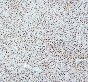 IHC staining of FFPE mouse liver with PTBP2 antibody. HIER: boil tissue sections in pH6, 10mM citrate buffer, for 20 min and allow to cool before testing.