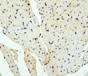 IHC staining of FFPE mouse heart with PTBP2 antibody. HIER: boil tissue sections in pH6, 10mM citrate buffer, for 20 min and allow to cool before testing.