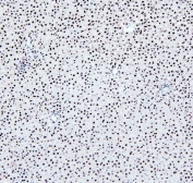 IHC staining of FFPE rat liver with PTBP2 antibody. HIER: boil tissue sections in pH6, 10mM citrate buffer, for 20 min and allow to cool before testing.