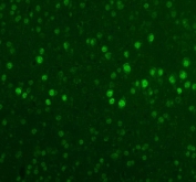 IHC staining of FFPE mouse gastric tissue with Fox2 antibody. HIER: boil tissue sections in pH6, 10mM citrate buffer, for 20 min and allow to cool before testing.