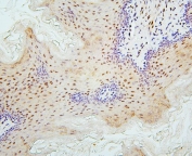 IHC staining of FFPE rat gastric tissue with Fox2 antibody. HIER: boil tissue sections in pH6, 10mM citrate buffer, for 20 min and allow to cool before testing.