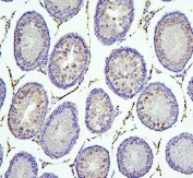 IHC staining of FFPE rat testis with SIRT1 antibody. HIER: boil tissue sections in pH6, 10mM citrate buffer, for 20 min and allow to cool before testing.