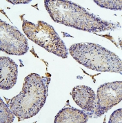 IHC staining of FFPE mouse testis with SIRT1 antibody. HIER: boil tissue sections in pH6, 10mM citrate buffer, for 20 min and allow to cool before testing.