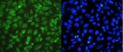 Immunofluorescent staining of FFPE human U-2 OS cells with SIRT1 antibody. HIER: boil tissue sections in pH6, 10mM citrate buffer, for 20 min and allow to cool before testing.