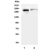 Western blot testing of 1) rat testis and 2) mouse testis lysate with SMARCA2 antibody. Predicted molecular weight ~181 kDa.