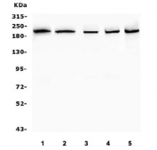 Western blot testing of human 1) HL60, 2) ThP-1, 3) A549, 4) U-2 OS and 5) HeLa cell lysate with SMARCA2 antibody. Predicted molecular weight ~181 kDa.