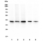 Western blot testing of human 1) HepG2, 2) Jurkat, 3) Caco-2, 4) HeLa and 5) A549 cell lysate with RP2 antibody. Predicted molecular weight ~40 kDa.