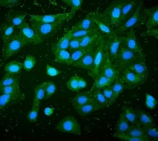 Immunofluorescent staining of FFPE human U-2 OS cells with RP2 antibody (green) and DAPI (blue). HIER: boil tissue sections in pH6, 10mM citrate buffer, for 20 min and allow to cool before testing.