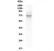 Western blot testing of rat thymus lysate with SYK antibody. Predicted molecular weight ~72 kDa.