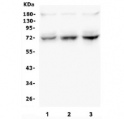 Western blot testing of mouse 1) thymus, 2) lung and 3) SP20 lysate with SYK antibody. Predicted molecular weight ~72 kDa.