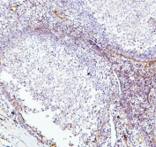 IHC staining of FFPE human tonsil with TIE2 antibody. HIER: boil tissue sections in pH6, 10mM citrate buffer, for 20 min and allow to cool before testing.