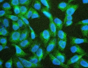Immunofluorescent staining of FFPE human U-2 OS with TIE2 antibody (green) and DAPI (blue). HIER: boil tissue sections in pH6, 10mM citrate buffer, for 20 min and allow to cool before testing.