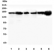 Western blot testing of human 1) HeLa, 2) U-87 MG, 3) U-2 OS, 4) A431, 5) PC-3 and 6) HL60 lysate with TIE2 antibody. Predicted molecular weight: ~126 kDa but may be observable at 130-165 kDa.