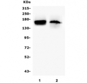 Western blot testing of mouse 1) lung and 2) Neuro-2a lysate with TIE2 antibody. Predicted molecular weight: ~126 kDa but may be observable at 130-165 kDa.