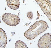 IHC staining of FFPE mouse testis with TIE2 antibody. HIER: boil tissue sections in pH6, 10mM citrate buffer, for 20 min and allow to cool before testing.