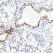 IHC staining of FFPE rat lung with TIE2 antibody. HIER: boil tissue sections in pH6, 10mM citrate buffer, for 20 min and allow to cool before testing.
