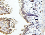 IHC staining of FFPE rat intestine with TIE2 antibody. HIER: boil tissue sections in pH6, 10mM citrate buffer, for 20 min and allow to cool before testing.