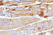 IHC staining of FFPE rat skeletal muscle with TNNI2 antibody. HIER: boil tissue sections in pH6, 10mM citrate buffer, for 20 min and allow to cool before testing.