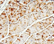 IHC staining of FFPE mouse skeletal muscle with TNNI2 antibody. HIER: boil tissue sections in pH6, 10mM citrate buffer, for 20 min and allow to cool before testing.