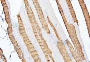 IHC staining of FFPE human skeletal muscle with TNNI2 antibody. HIER: boil tissue sections in pH6, 10mM citrate buffer, for 20 min and allow to cool before testing.